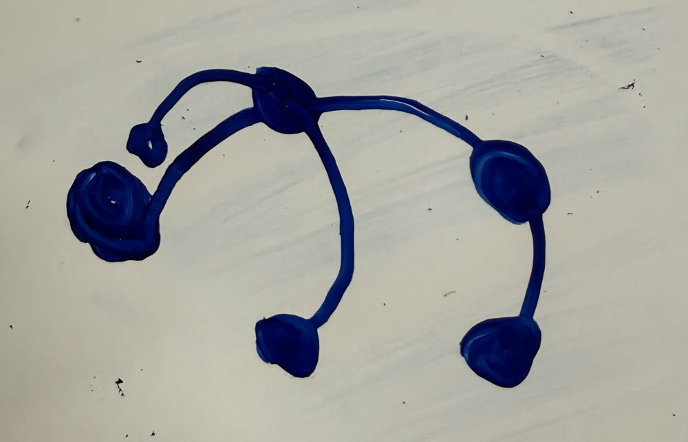 Blue marker sketch on a whiteboard: a band over the head with round sensor pads.
